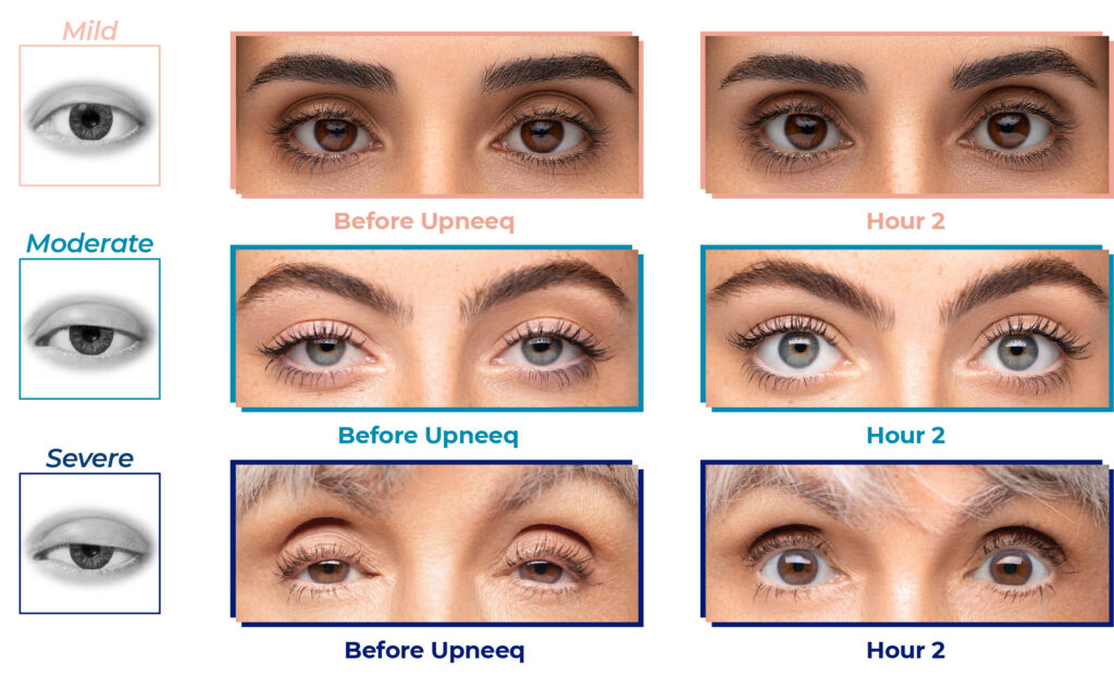 upneeq_before-and-after